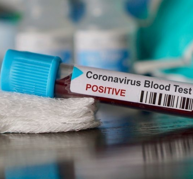 �����������. ���������� ���������� �������� 1 ��� �������